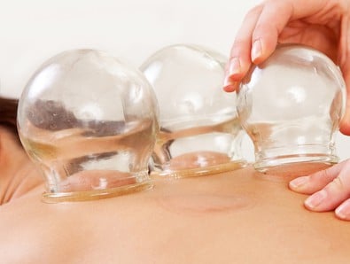 A woman enjoying a massage while three glass jars create a slipstream effect on her back.